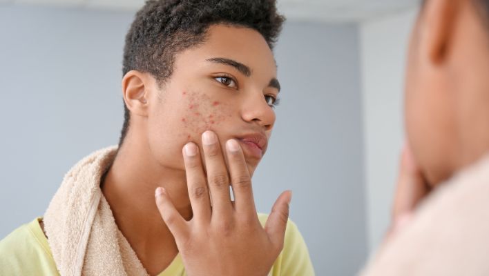 The Best Skin Care Routine For Teenage Guys