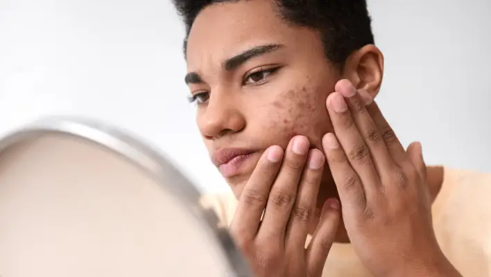 The Best Skin Care Routine For Teenage Guys