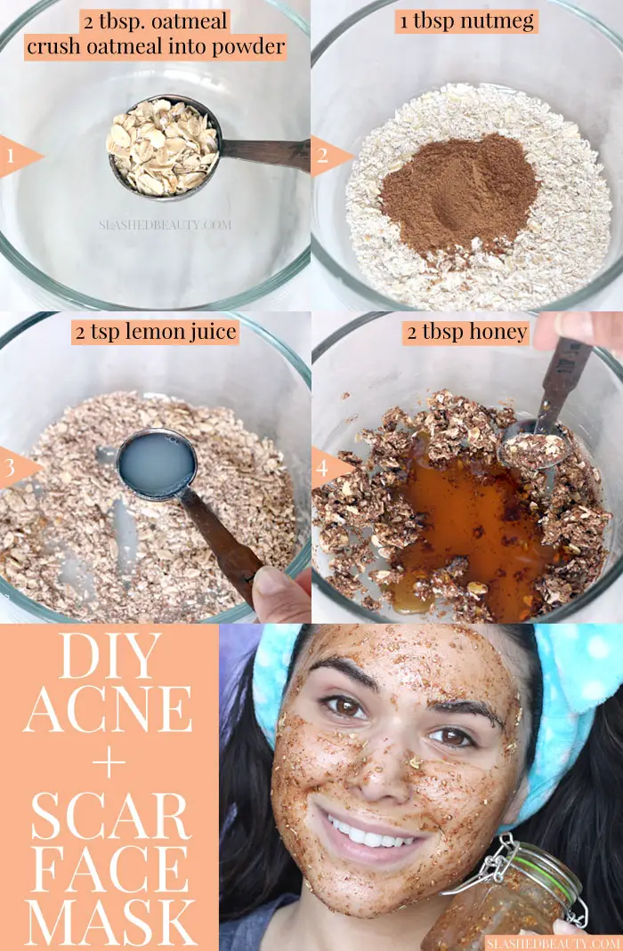 Face Mask for Acne